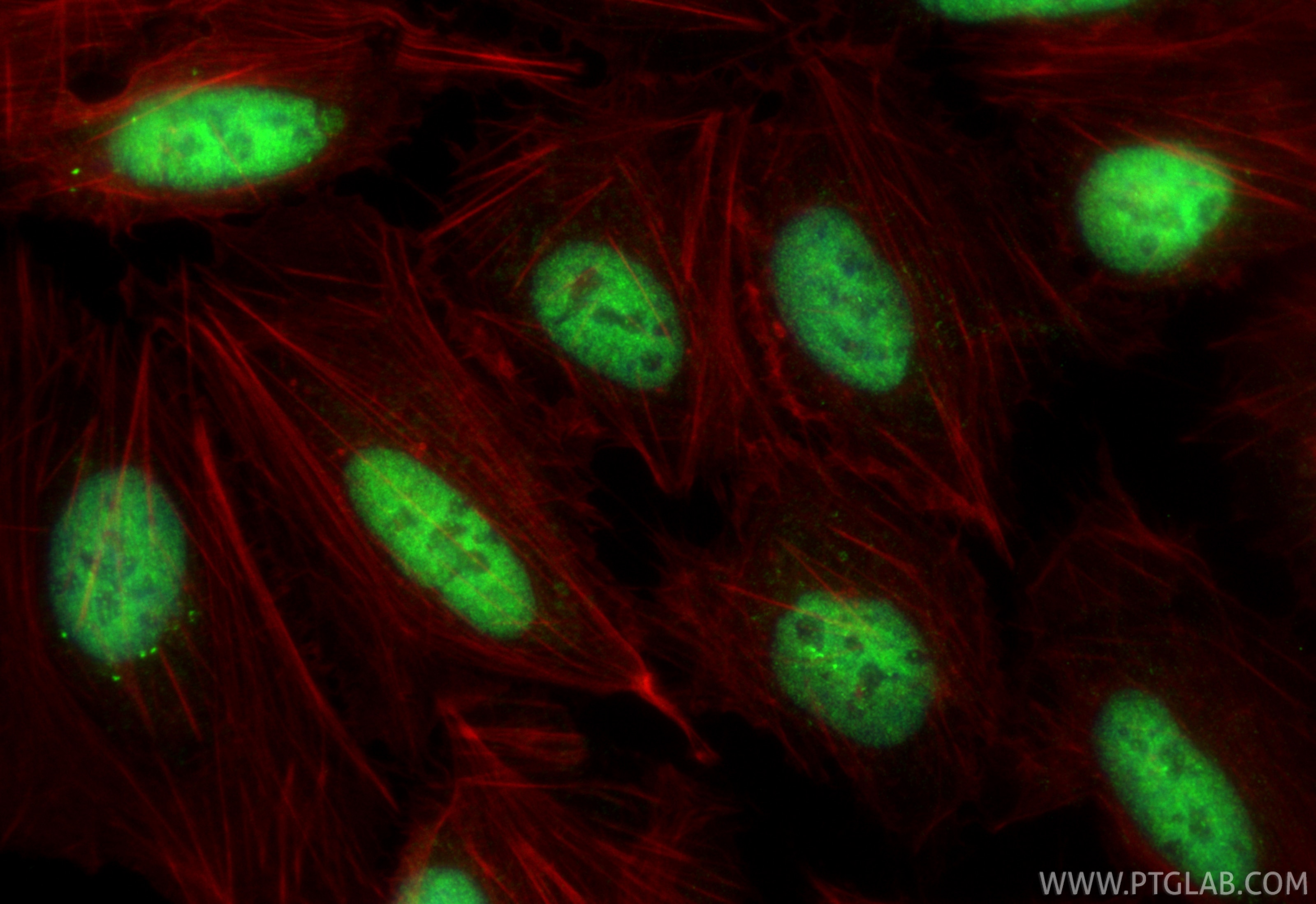 IF Staining of U2OS using 33838-1-AP Immunofluorescence (IF) / fluorescent staining of U2OS cells using ZNF157 Polyclonal antibody (33838-1-AP)
