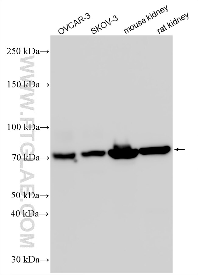 Western Blot (WB) analysis of various lysates using ZNF16 Polyclonal antibody (26374-1-AP)
