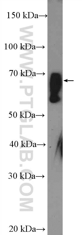 ZNF169