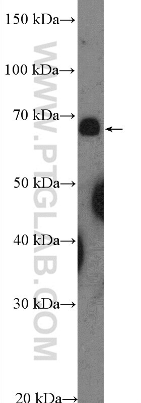 Western Blot (WB) analysis of HepG2 cells using ZNF169 Polyclonal antibody (26344-1-AP)