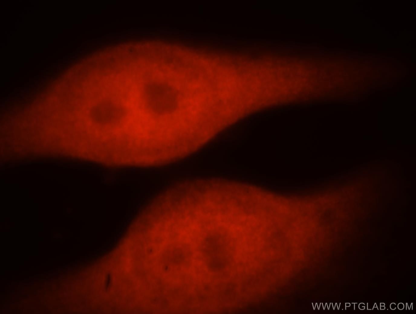 Immunofluorescence (IF) / fluorescent staining of HeLa cells using ZNF174 Polyclonal antibody (18157-1-AP)