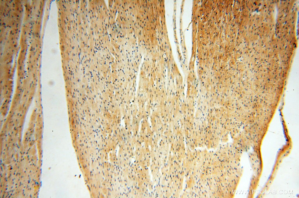 Immunohistochemistry (IHC) staining of human heart tissue using ZNF174 Polyclonal antibody (18157-1-AP)