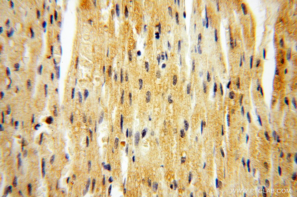 Immunohistochemistry (IHC) staining of human heart tissue using ZNF174 Polyclonal antibody (18157-1-AP)