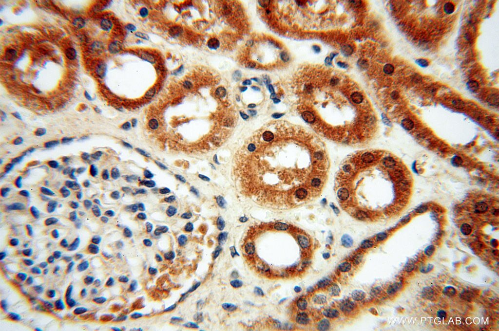 Immunohistochemistry (IHC) staining of human kidney tissue using ZNF174 Polyclonal antibody (18157-1-AP)