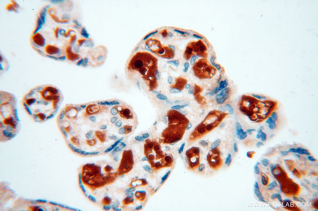 Immunohistochemistry (IHC) staining of human placenta tissue using ZNF174 Polyclonal antibody (18157-1-AP)