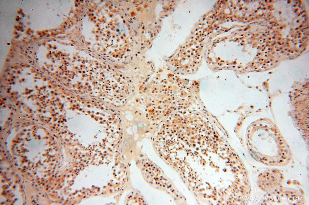 Immunohistochemistry (IHC) staining of human testis tissue using ZNF174 Polyclonal antibody (18157-1-AP)