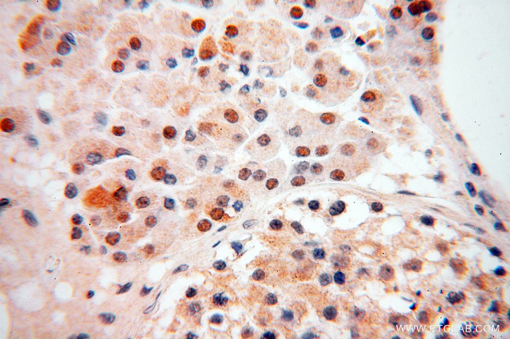Immunohistochemistry (IHC) staining of human testis tissue using ZNF174 Polyclonal antibody (18157-1-AP)