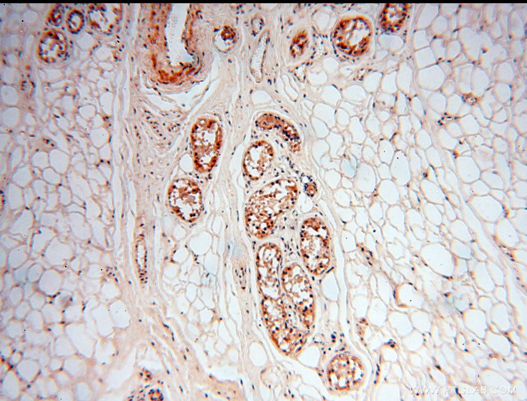 Immunohistochemistry (IHC) staining of human skin tissue using ZNF174 Polyclonal antibody (18157-1-AP)