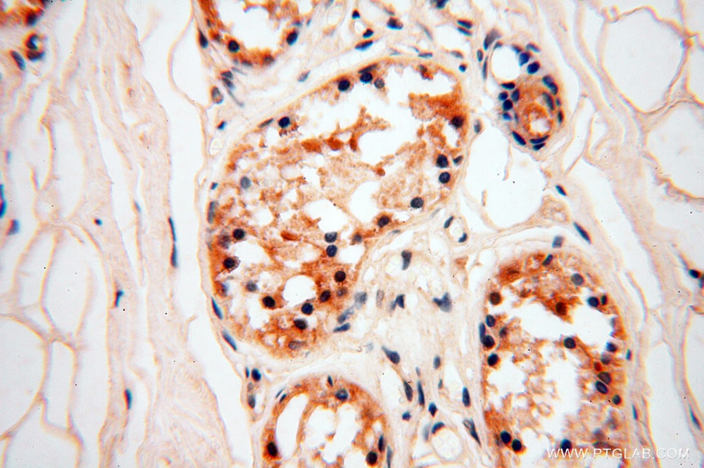 Immunohistochemistry (IHC) staining of human skin tissue using ZNF174 Polyclonal antibody (18157-1-AP)