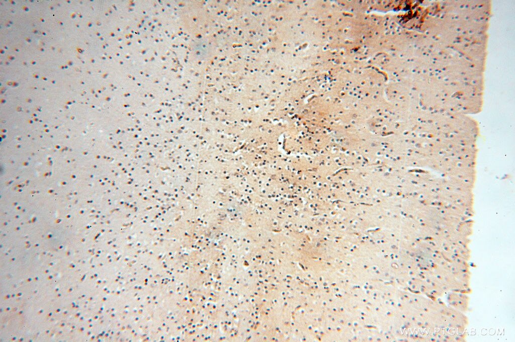 Immunohistochemistry (IHC) staining of human brain tissue using ZNF174 Polyclonal antibody (18157-1-AP)