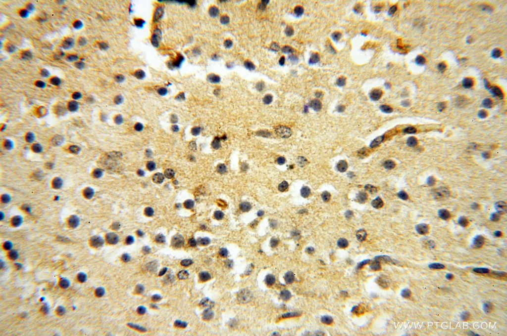 Immunohistochemistry (IHC) staining of human brain tissue using ZNF174 Polyclonal antibody (18157-1-AP)