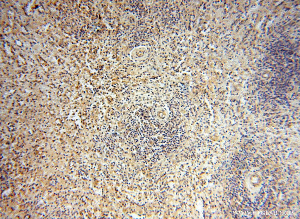 Immunohistochemistry (IHC) staining of human spleen tissue using ZNF174 Polyclonal antibody (18157-1-AP)