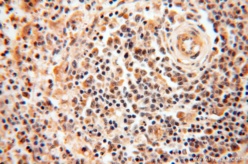 Immunohistochemistry (IHC) staining of human spleen tissue using ZNF174 Polyclonal antibody (18157-1-AP)