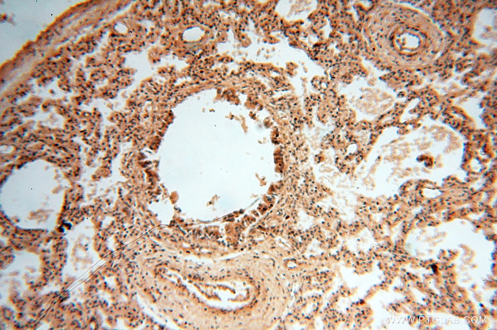 Immunohistochemistry (IHC) staining of human lung tissue using ZNF174 Polyclonal antibody (18157-1-AP)