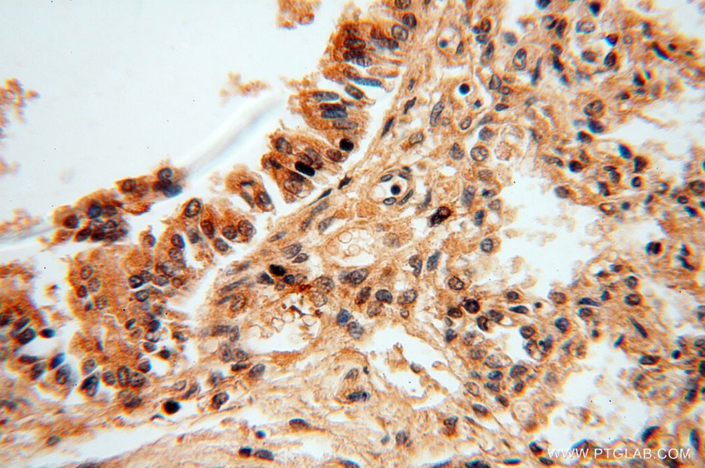 Immunohistochemistry (IHC) staining of human lung tissue using ZNF174 Polyclonal antibody (18157-1-AP)