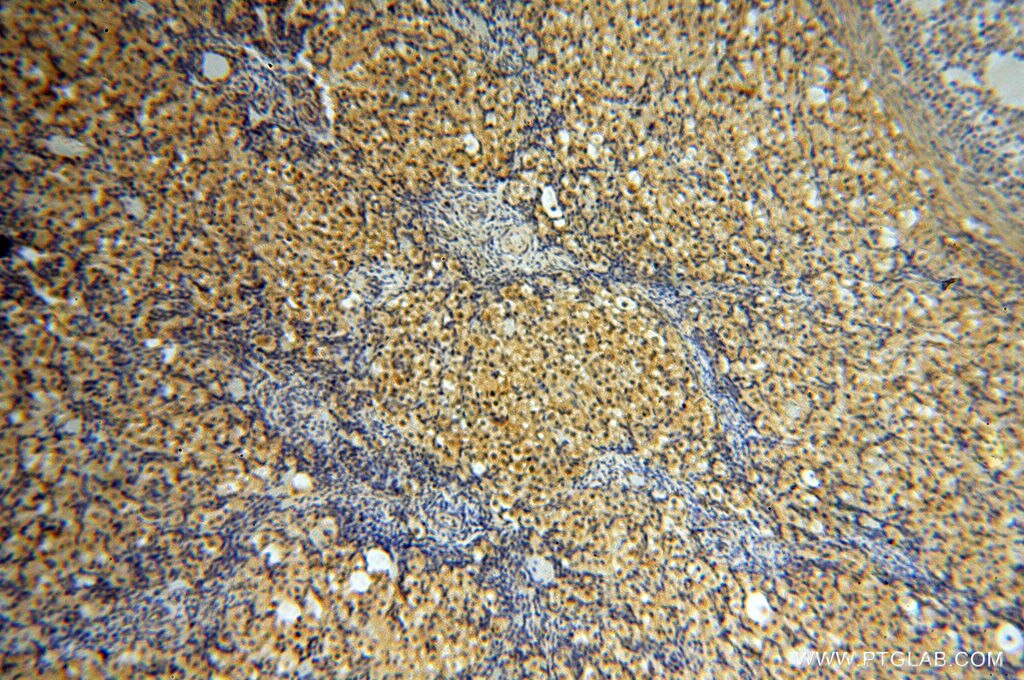 Immunohistochemistry (IHC) staining of human ovary tissue using ZNF174 Polyclonal antibody (18157-1-AP)