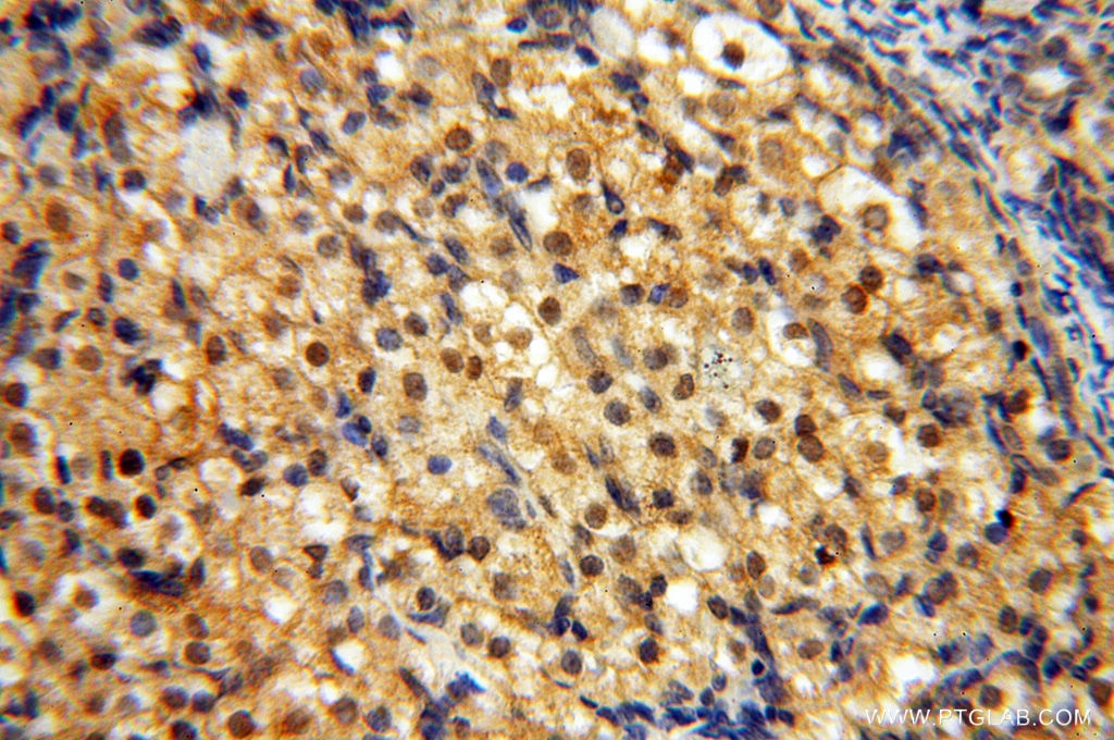 Immunohistochemistry (IHC) staining of human ovary tissue using ZNF174 Polyclonal antibody (18157-1-AP)