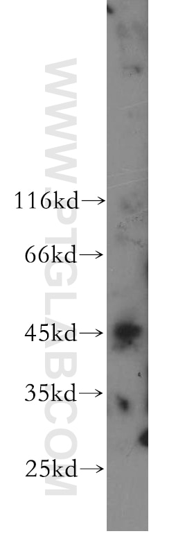 Western Blot (WB) analysis of BxPC-3 cells using ZNF174 Polyclonal antibody (18157-1-AP)