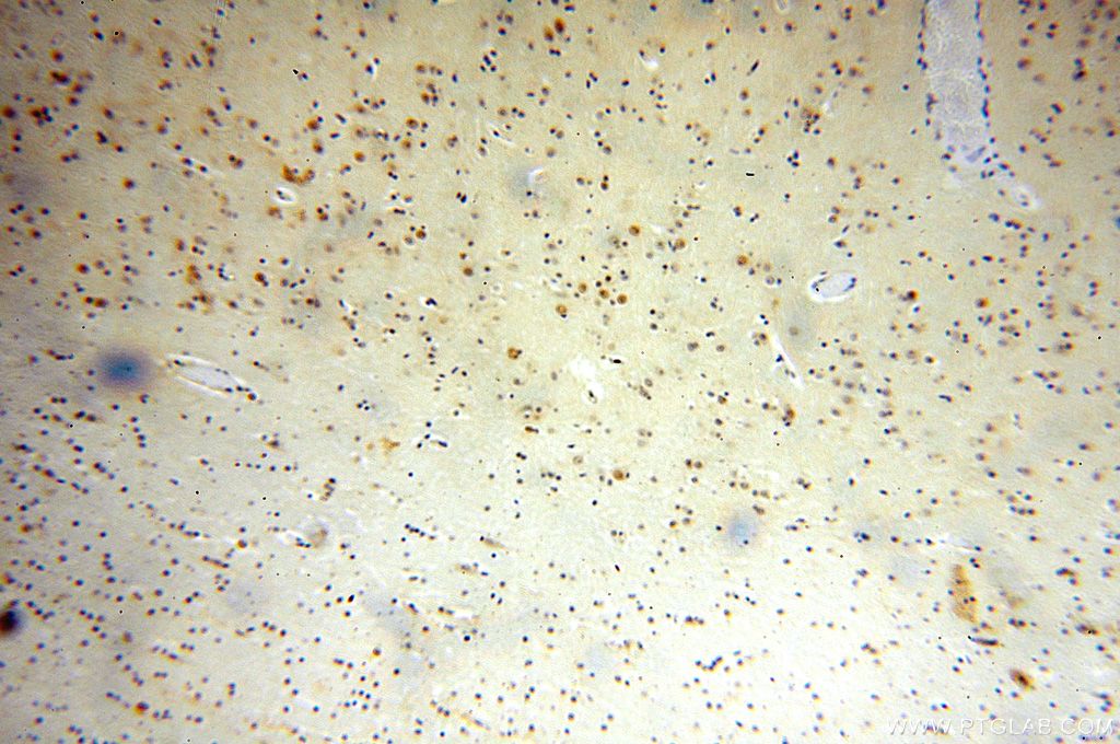 Immunohistochemistry (IHC) staining of human brain tissue using ZNF18 Polyclonal antibody (17070-1-AP)