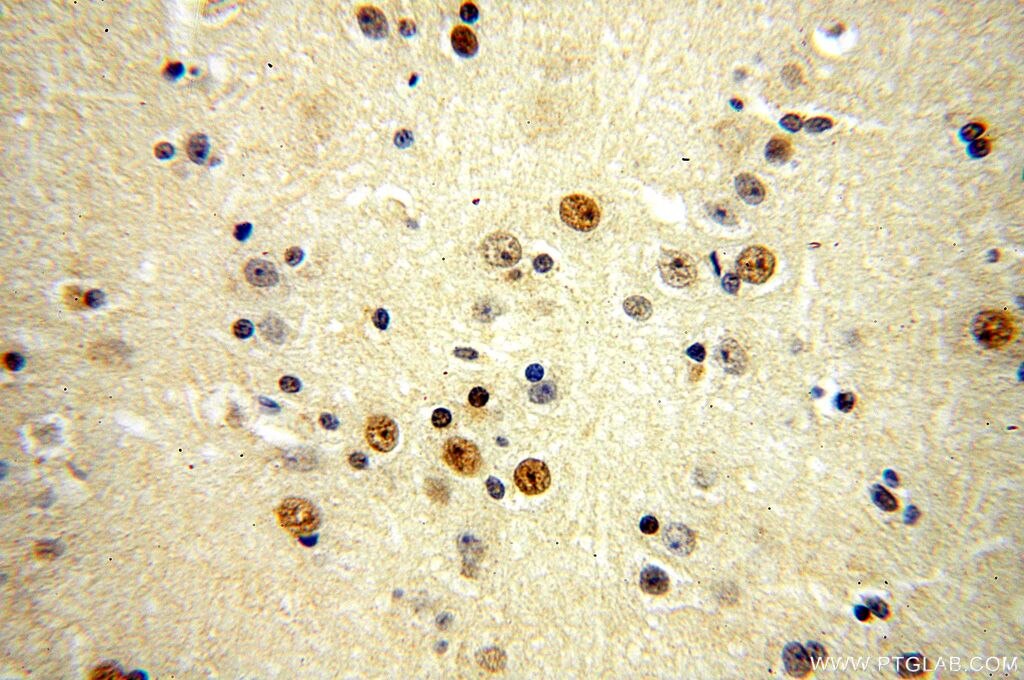 Immunohistochemistry (IHC) staining of human brain tissue using ZNF18 Polyclonal antibody (17070-1-AP)