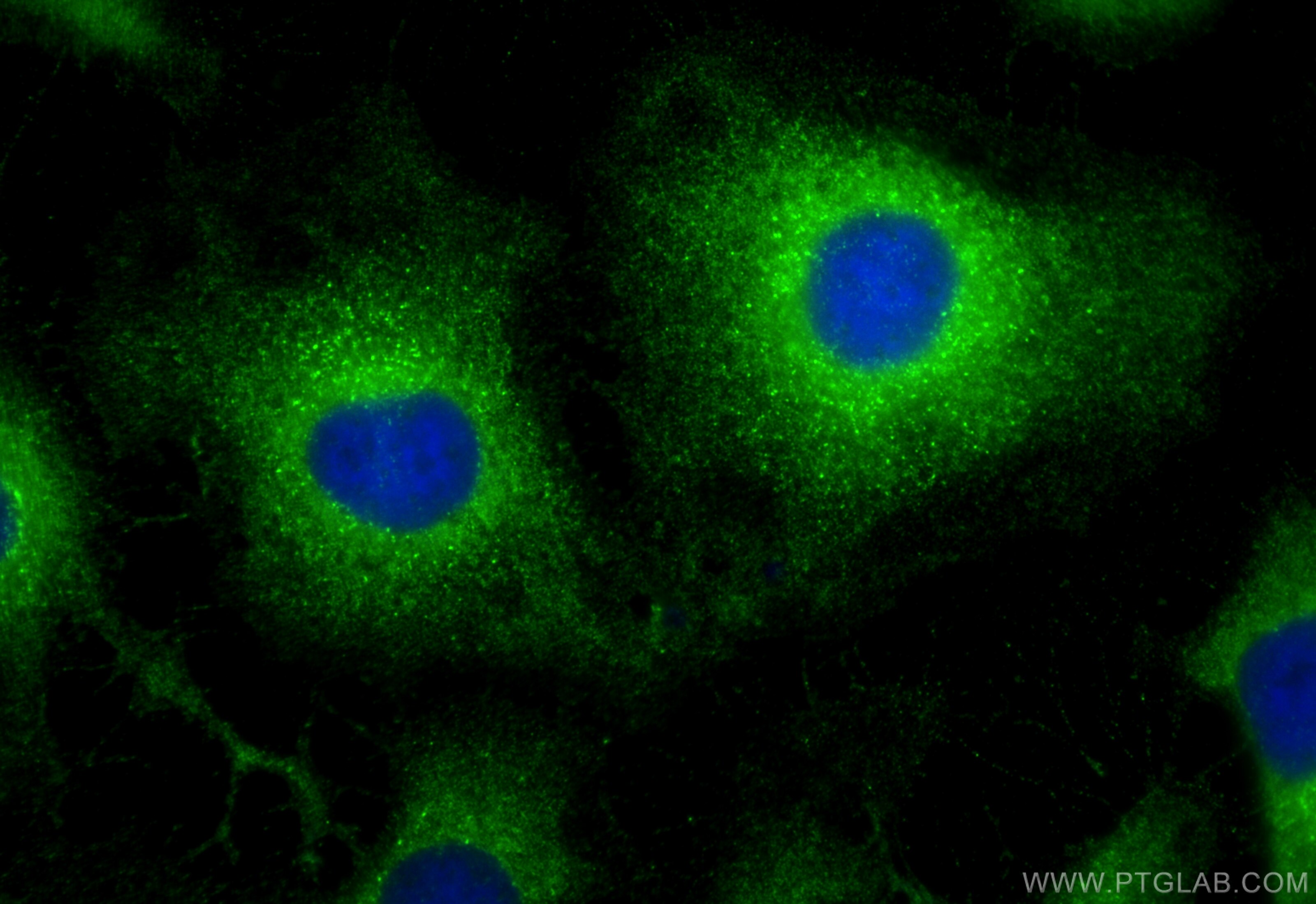 IF Staining of HeLa using 31477-1-AP Immunofluorescence (IF) / fluorescent staining of HeLa cells using ZNF185 Polyclonal antibody (31477-1-AP)