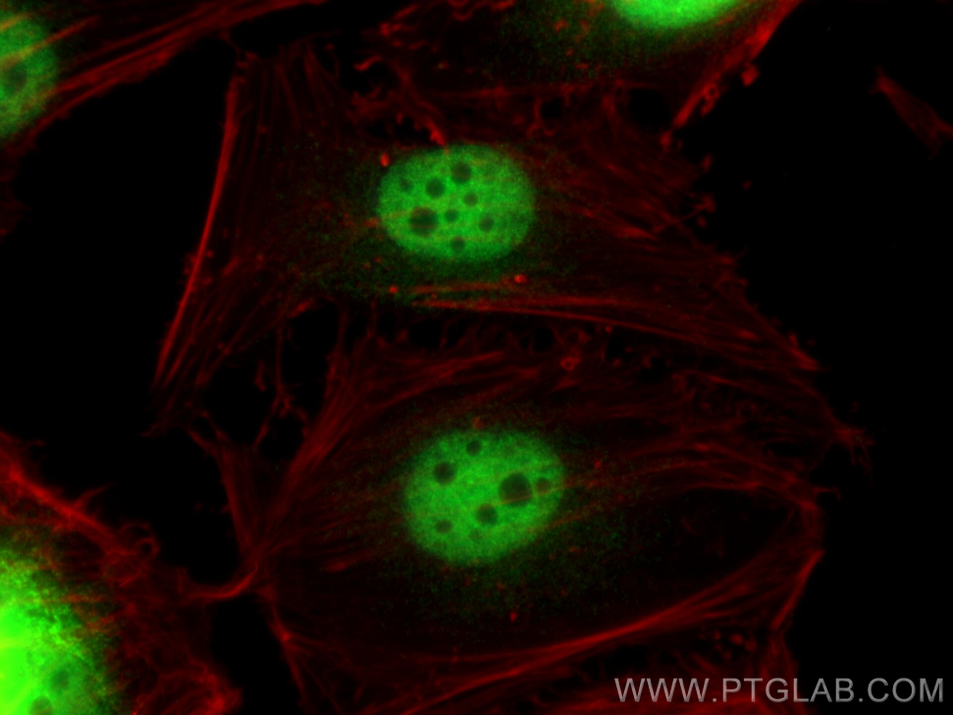 Immunofluorescence (IF) / fluorescent staining of HeLa cells using ZNF189 Polyclonal antibody (26169-1-AP)