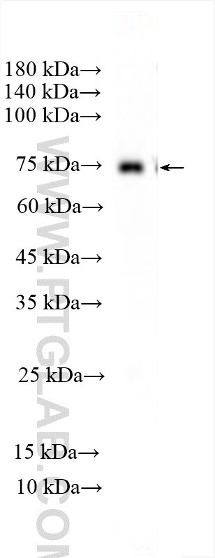 ZNF189