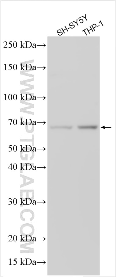Western Blot (WB) analysis of various lysates using ZNF189 Polyclonal antibody (26169-1-AP)