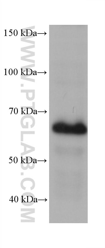 Western Blot (WB) analysis of HeLa cells using ZNF189 Monoclonal antibody (68424-1-Ig)