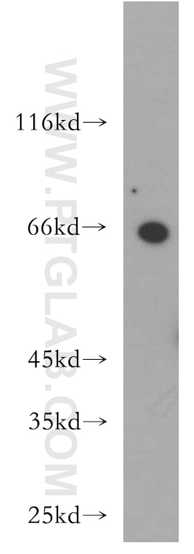 Western Blot (WB) analysis of HeLa cells using ZNF192 Polyclonal antibody (21656-1-AP)