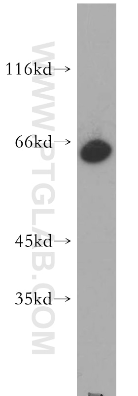Western Blot (WB) analysis of HepG2 cells using ZNF192 Polyclonal antibody (21656-1-AP)
