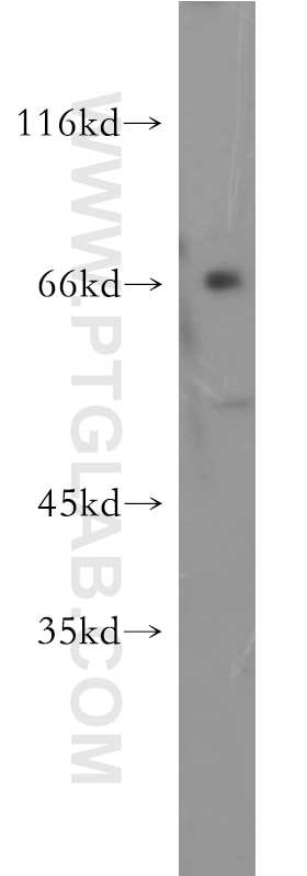 Western Blot (WB) analysis of mouse ovary tissue using ZNF192 Polyclonal antibody (21656-1-AP)