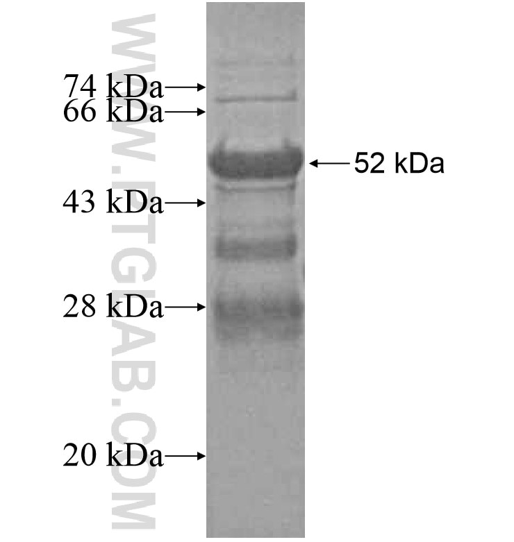 ZNF192 fusion protein Ag16381 SDS-PAGE