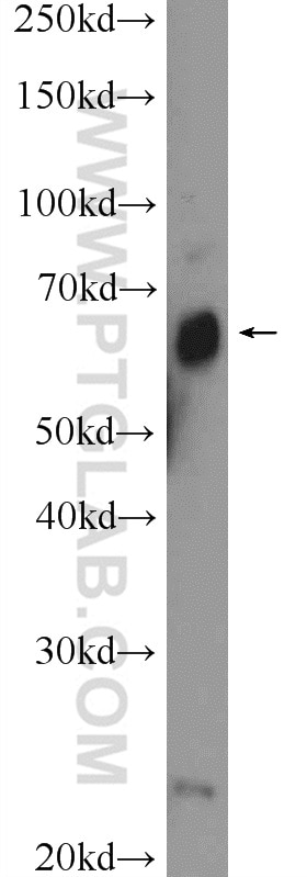 Western Blot (WB) analysis of fetal human brain tissue using ZNF195 Polyclonal antibody (24861-1-AP)