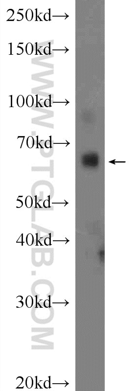Western Blot (WB) analysis of mouse skeletal muscle tissue using ZNF195 Polyclonal antibody (24861-1-AP)
