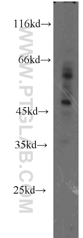 Western Blot (WB) analysis of mouse spleen tissue using ZNF2 Polyclonal antibody (11282-1-AP)