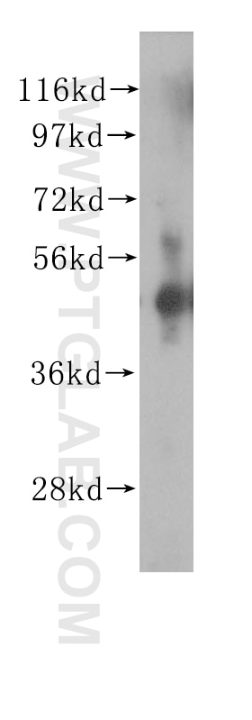 Western Blot (WB) analysis of human spleen tissue using ZNF2 Polyclonal antibody (11282-1-AP)