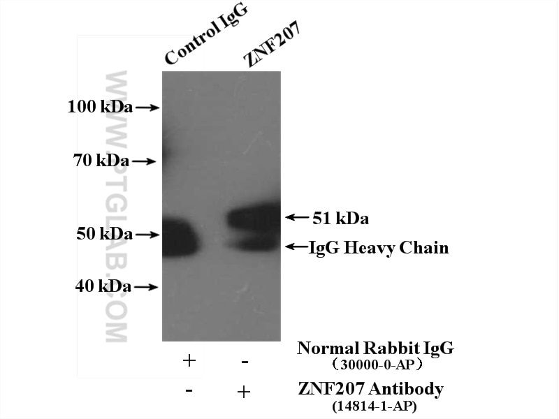 Immunoprecipitation (IP) experiment of HepG2 cells using ZNF207 Polyclonal antibody (14814-1-AP)
