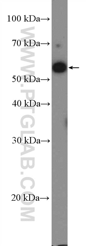 Western Blot (WB) analysis of HepG2 cells using ZNF207 Polyclonal antibody (14814-1-AP)