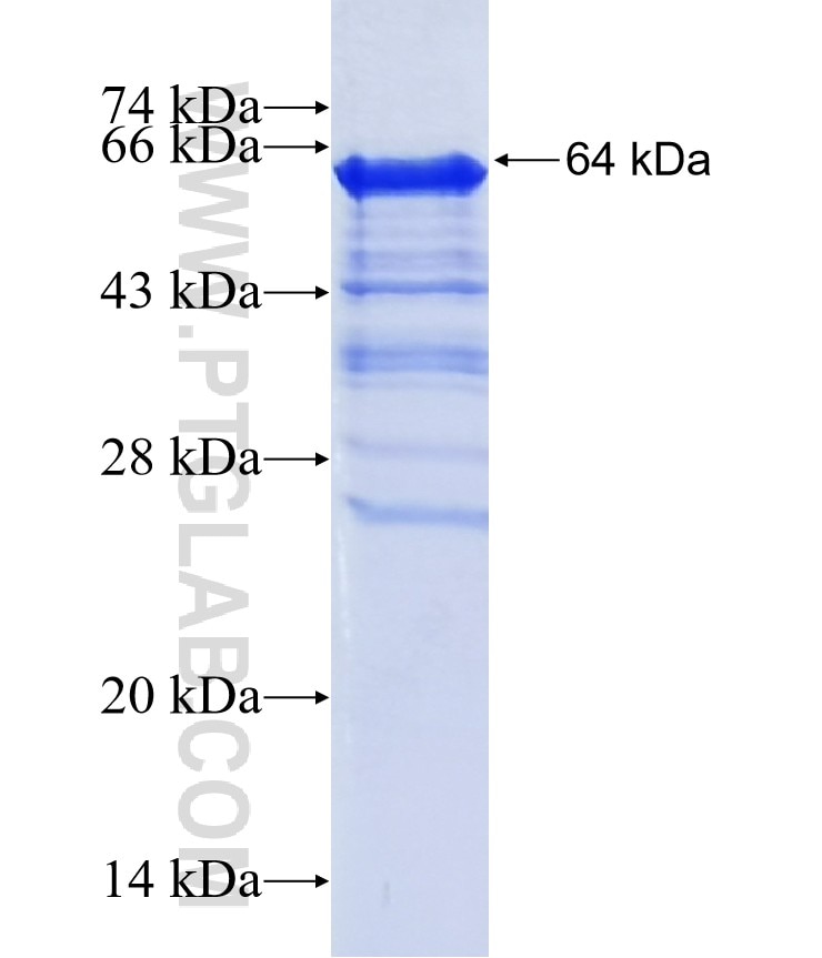 ZNF207 fusion protein Ag40360 SDS-PAGE