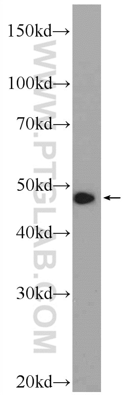 Western Blot (WB) analysis of Jurkat cells using ZNF211 Polyclonal antibody (25458-1-AP)