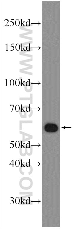 Western Blot (WB) analysis of HeLa cells using ZNF211 Polyclonal antibody (25458-1-AP)