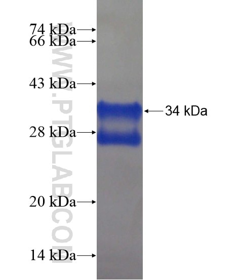 ZNF211 fusion protein Ag22135 SDS-PAGE