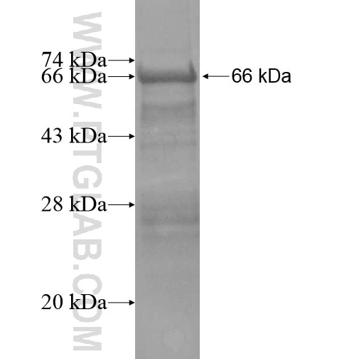 ZNF213 fusion protein Ag14856 SDS-PAGE ZNF213 fusion protein Ag14856 SDS-PAGE