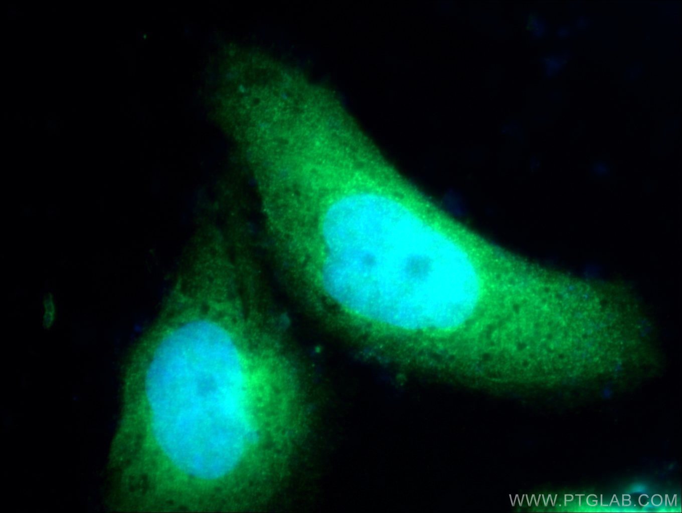 Immunofluorescence (IF) / fluorescent staining of HepG2 cells using ZNF215 Polyclonal antibody (25502-1-AP)