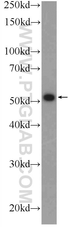 Western Blot (WB) analysis of mouse brain tissue using ZNF215 Polyclonal antibody (25502-1-AP)