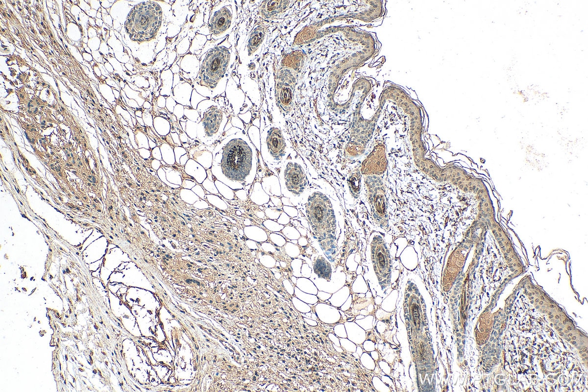 Immunohistochemistry (IHC) staining of mouse skin tissue using ZNF217 Monoclonal antibody (67730-1-Ig)