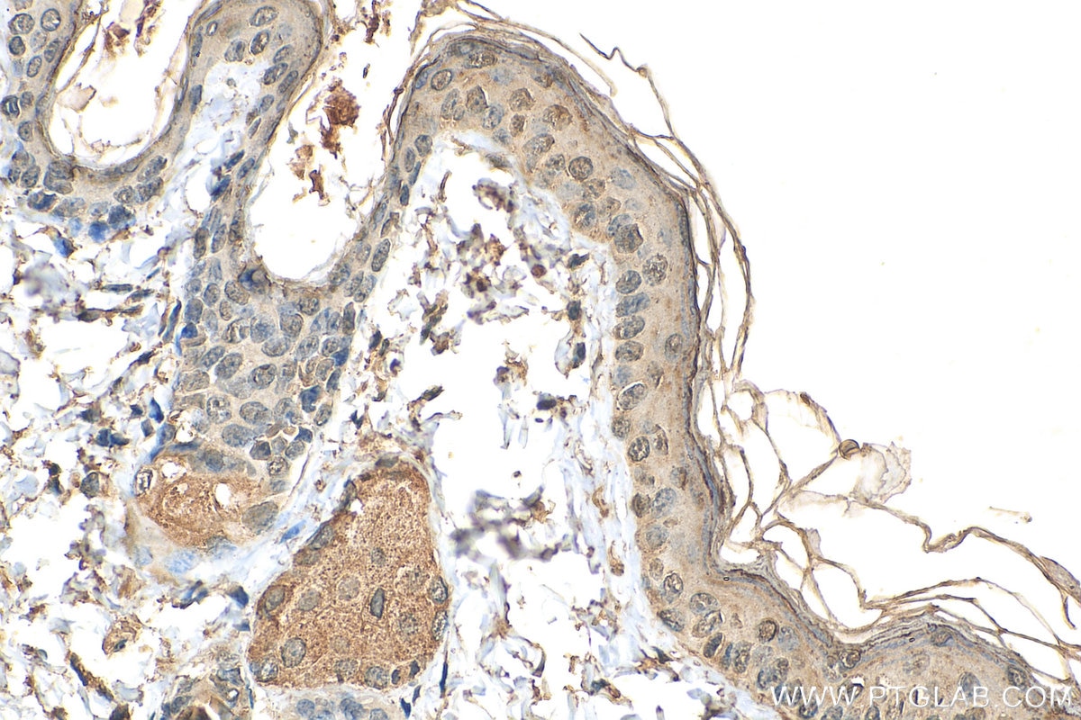 Immunohistochemistry (IHC) staining of mouse skin tissue using ZNF217 Monoclonal antibody (67730-1-Ig)