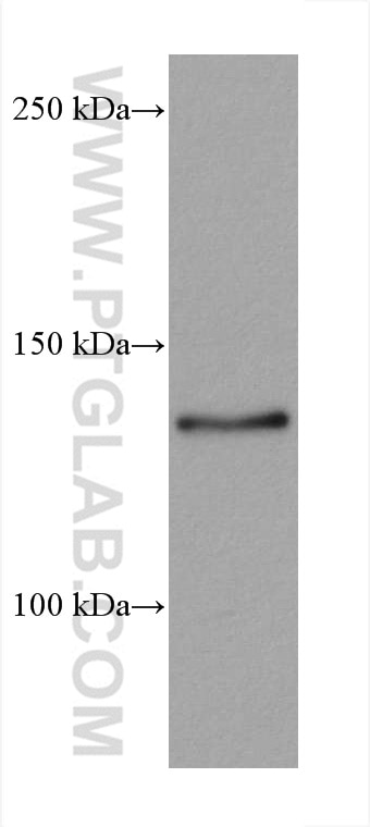 Western Blot (WB) analysis of 4T1 cells using ZNF217 Monoclonal antibody (67730-1-Ig)