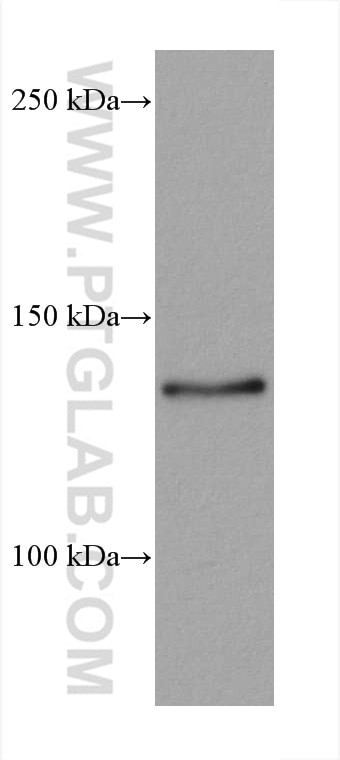 WB analysis of 4T1 using 67730-1-Ig